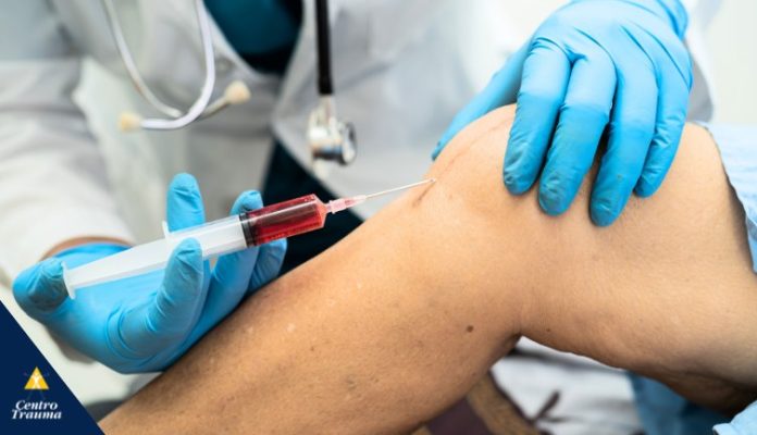 viscossuplementação